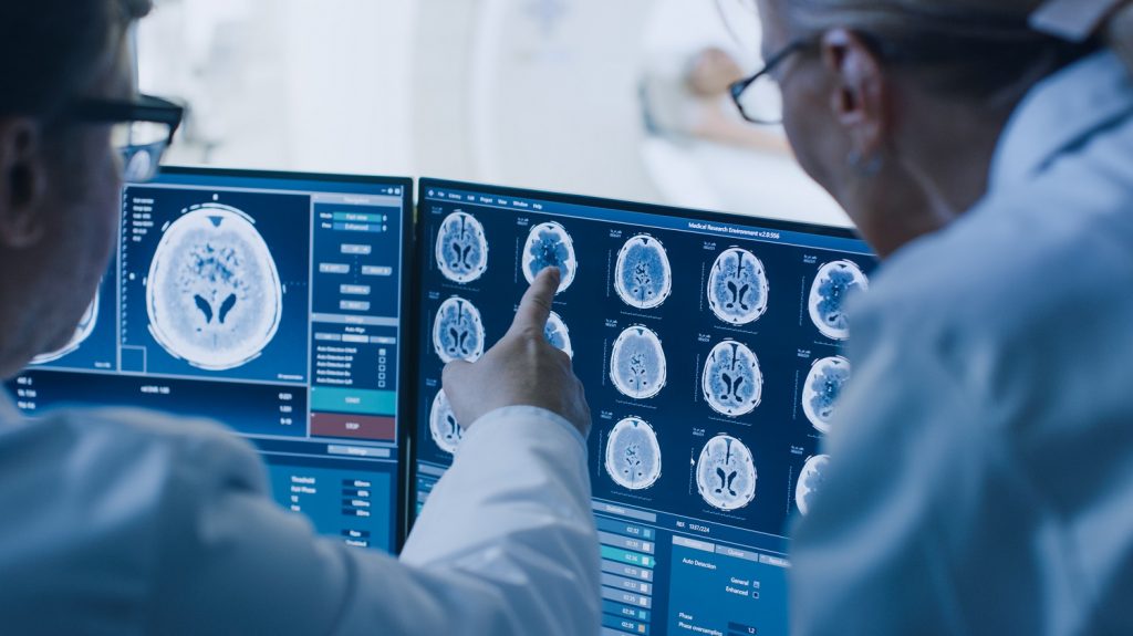 Brain stress test for assessing cerebrovascular reactivity in the aging brain