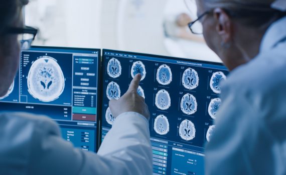 Brain stress test for assessing cerebrovascular reactivity in the aging brain